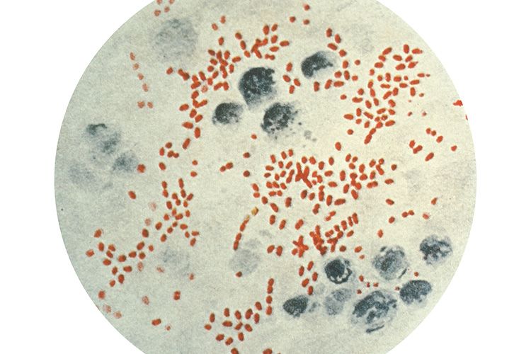 Plague under a microscope