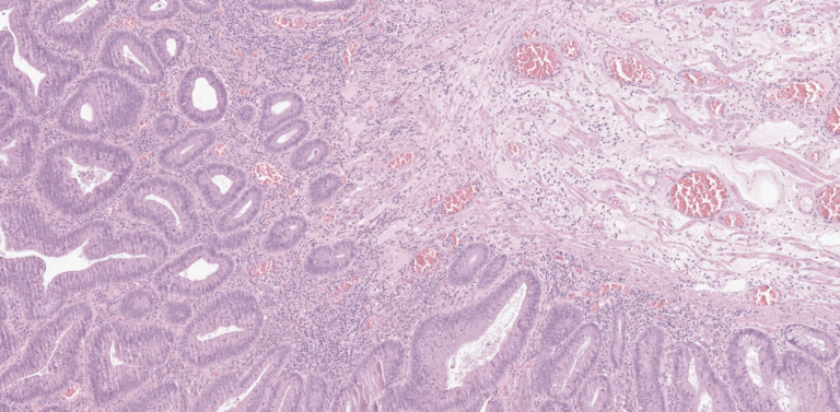 A whole slide image (WSI) section of human tissue from an open-source colorectal cancer cohort.