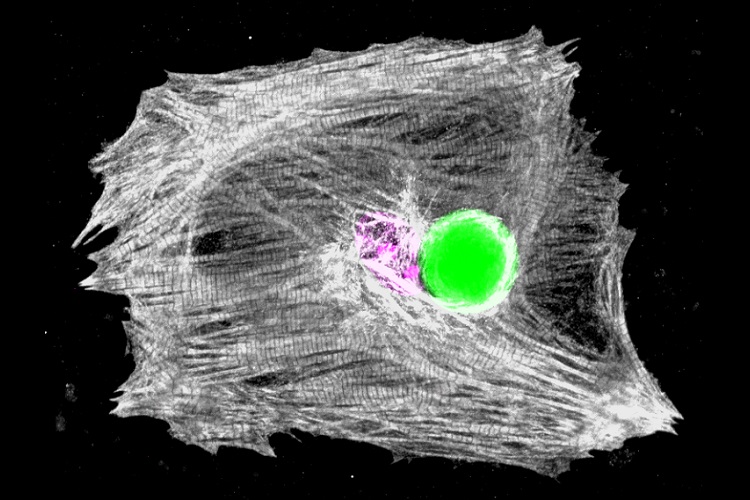 Microscopy image of a heart muscle cell with a tiny embedded laser emitting bright green light.