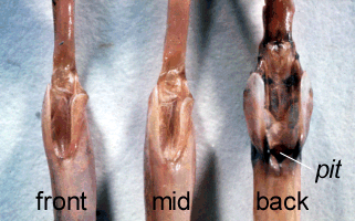 lump from the outside